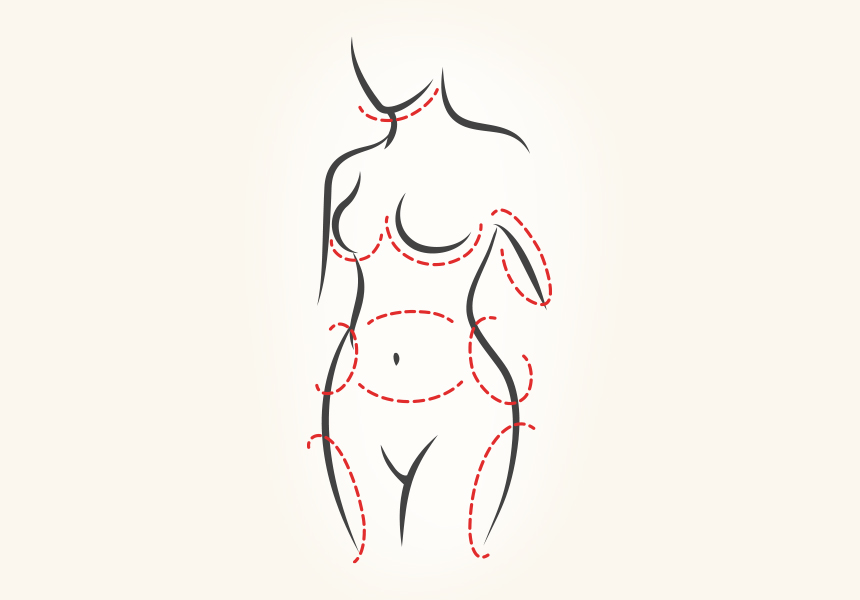 stevevu Benefits of liposuction graphic copy