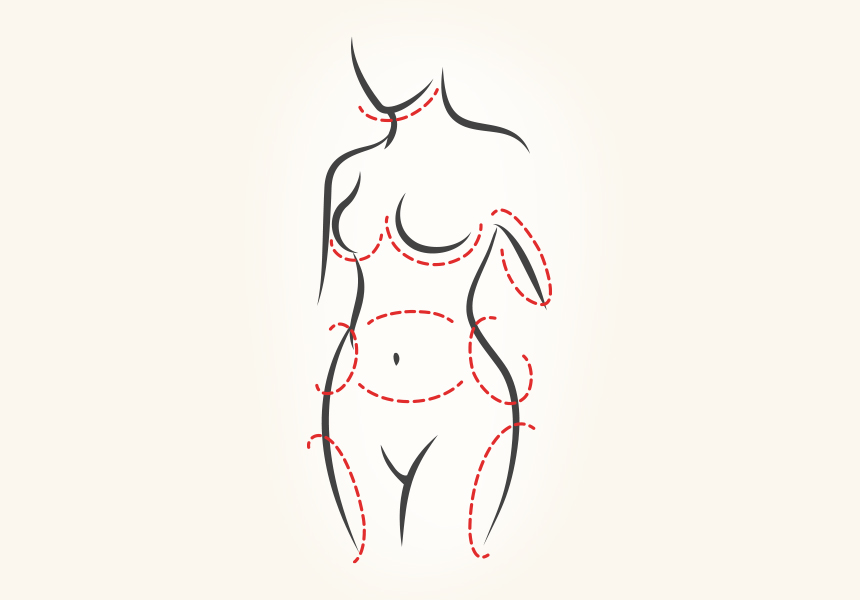 Liposuction Benefits Graphic