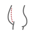 Droopy or loose skin around the abdomen
